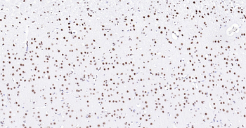 TARDBP Ready-To-Use IHC Kit