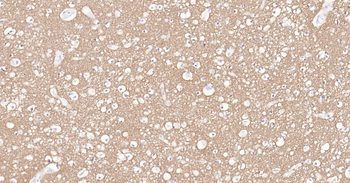 Human Tau-4 Ready-To-Use IHC Kit
