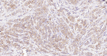 Human Tau-4 Ready-To-Use IHC Kit