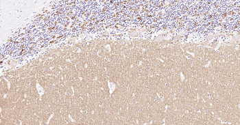 Human SYP Ready-To-Use IHC Kit