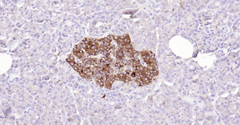 SYP Ready-To-Use IHC Kit