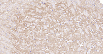 SYP Ready-To-Use IHC Kit