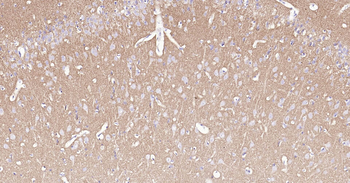 SYP Ready-To-Use IHC Kit