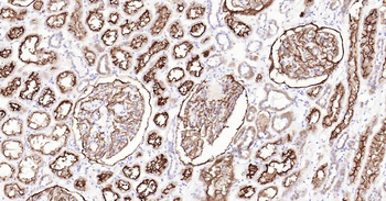 Human CD10 Ready-To-Use IHC Kit