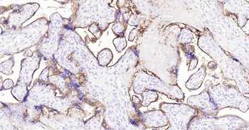 Human CD10 Ready-To-Use IHC Kit