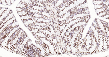 Mouse ERCC1 Ready-To-Use IHC Kit