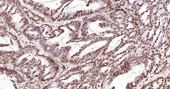ERCC1 Ready-To-Use IHC Kit