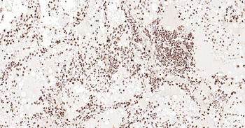 ERCC1 Ready-To-Use IHC Kit