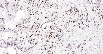 ERCC1 Ready-To-Use IHC Kit