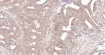 Human TYMS Ready-To-Use IHC Kit