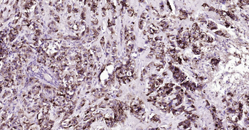 Human MUC1 Ready-To-Use IHC Kit