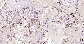 Human MUC1 Ready-To-Use IHC Kit
