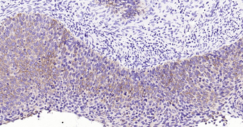 pan CK Ready-To-Use IHC Kit