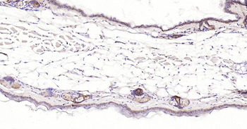 pan CK Ready-To-Use IHC Kit