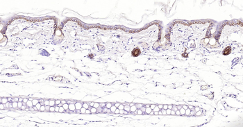 pan CK Ready-To-Use IHC Kit
