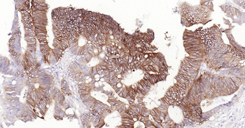 Human GPA33 Ready-To-Use IHC Kit