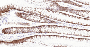 Human GPA33 Ready-To-Use IHC Kit