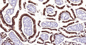 Human GPA33 Ready-To-Use IHC Kit