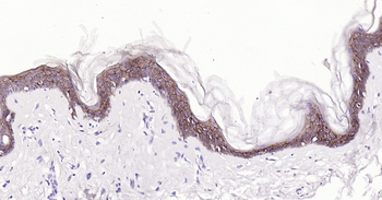 Human CADH1 Ready-To-Use IHC Kit