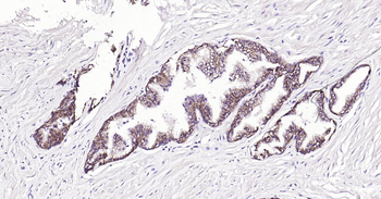 Human CADH1 Ready-To-Use IHC Kit