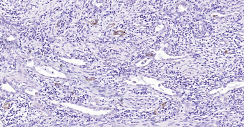Human SMMHC Ready-To-Use IHC Kit