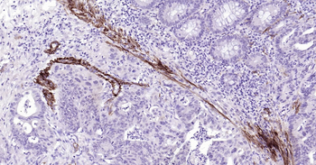 Human SMMHC Ready-To-Use IHC Kit