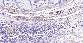 Human SMMHC Ready-To-Use IHC Kit