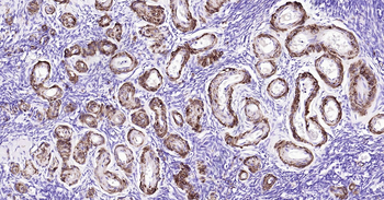 Human SMMHC Ready-To-Use IHC Kit