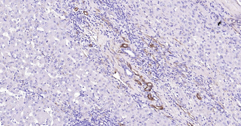 Human Caveolin-1 Ready-To-Use IHC Kit