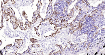 Human Caveolin-1 Ready-To-Use IHC Kit