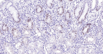 Human MCM7 Ready-To-Use IHC Kit