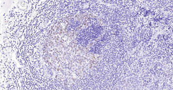 Human MCM7 Ready-To-Use IHC Kit