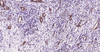 Human GSTP1 Ready-To-Use IHC Kit