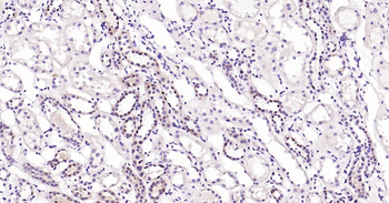 Human GSTP1 Ready-To-Use IHC Kit