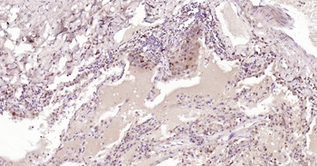 Human GSTP1 Ready-To-Use IHC Kit