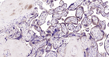 Human GSTP1 Ready-To-Use IHC Kit