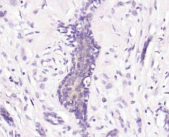 S100A11 Rabbit Polyclonal Antibody