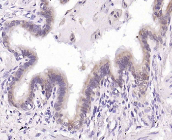 S100A11 Rabbit Polyclonal Antibody