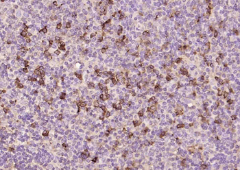 Human Lambda chain Mouse Monoclonal Antibody