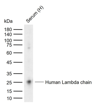 Human Lambda chain Mouse Monoclonal Antibody