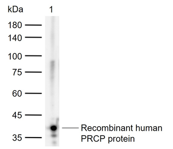 PRCP Rabbit Polyclonal Antibody