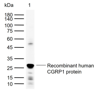 CGRP1 Rabbit Polyclonal Antibody