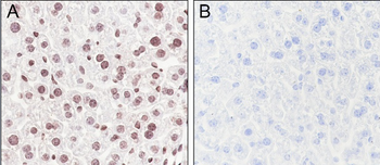 Acetyl Lysine Recombinant Rabbit Monoclonal Antibody
