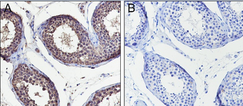 Benzoyllysine Mouse Monoclonal Antibody