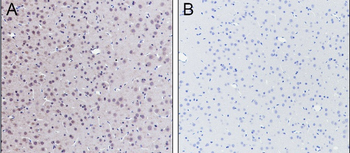 Benzoyllysine Mouse Monoclonal Antibody