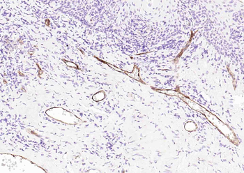 CD62p Recombinant Rabbit Monoclonal Antibody