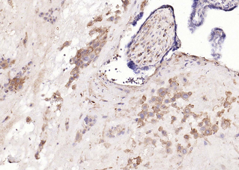 HLA E Rabbit Polyclonal Antibody