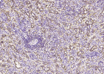 HLA E Rabbit Polyclonal Antibody
