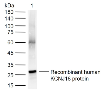 KCNJ18 Rabbit Polyclonal Antibody