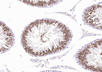 HE4 Mouse Monoclonal Antibody